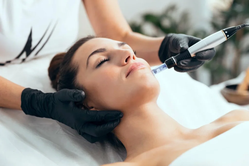 Microneedling Treatment