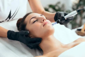 Microneedling Treatment