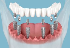 Dental Clinic Dubai