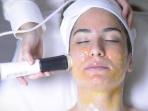 Microneedling Facial
