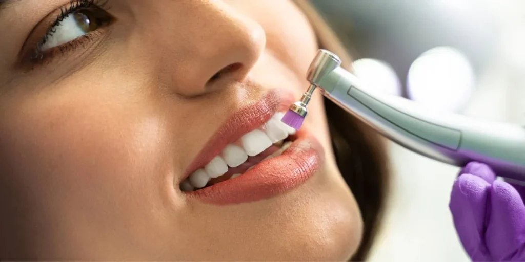 Teeth Cleaning in dubai