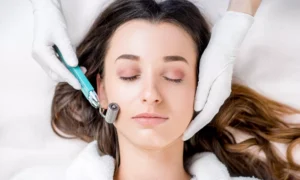 Microneedling Facial